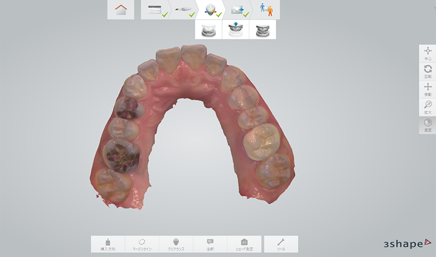 東京の歯医者、高輪歯科の睡眠歯科医療サービス、オーラルスリープ™とは