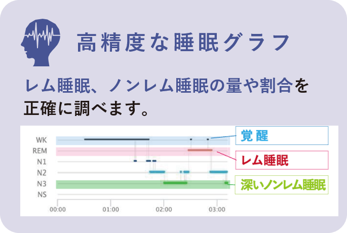 東京の歯医者、高輪歯科の睡眠歯科医療サービス、オーラルスリープ™の睡眠脳波計測