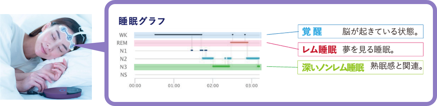 東京の歯医者、高輪歯科の睡眠歯科医療サービス、オーラルスリープ™の睡眠脳波計測