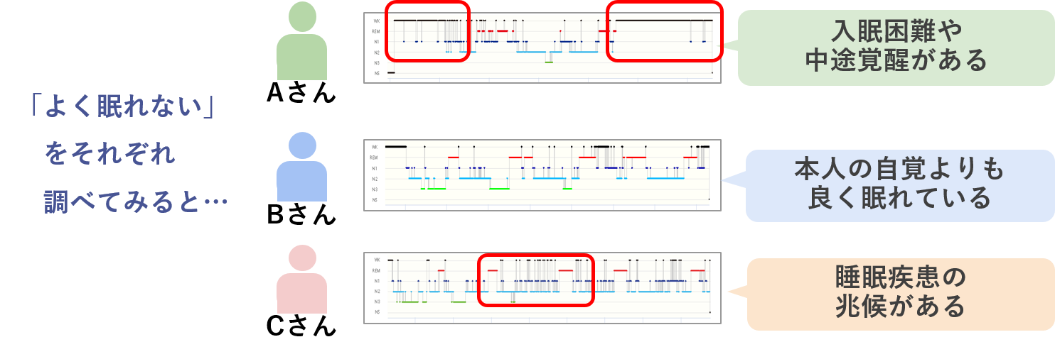 東京の歯医者、高輪歯科の睡眠歯科医療サービス、オーラルスリープ™の睡眠脳波計測