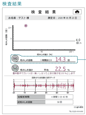 東京の歯医者、高輪歯科の睡眠歯科医療サービス、オーラルスリープ™の睡眠筋電計