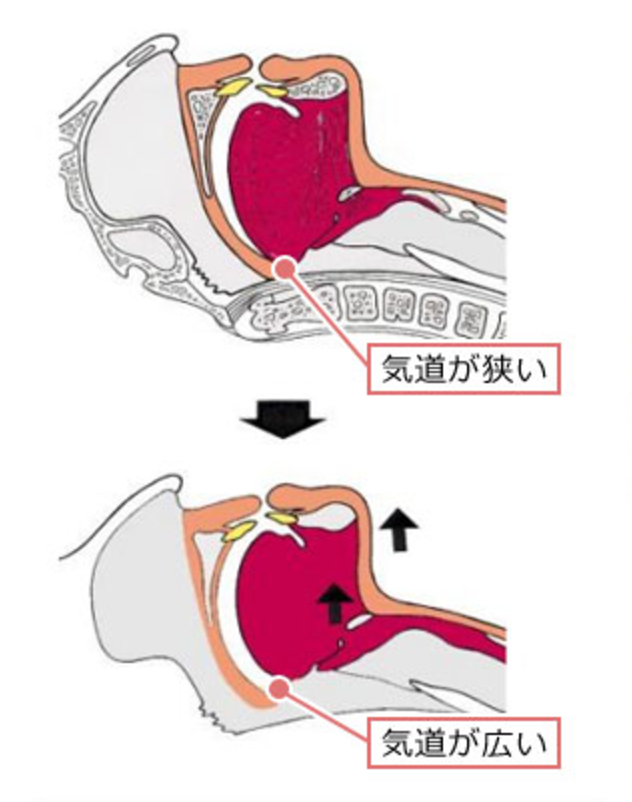 東京の歯医者、高輪歯科の睡眠歯科医療サービス、オーラルスリープ™で、いびきの種類と対策について解説