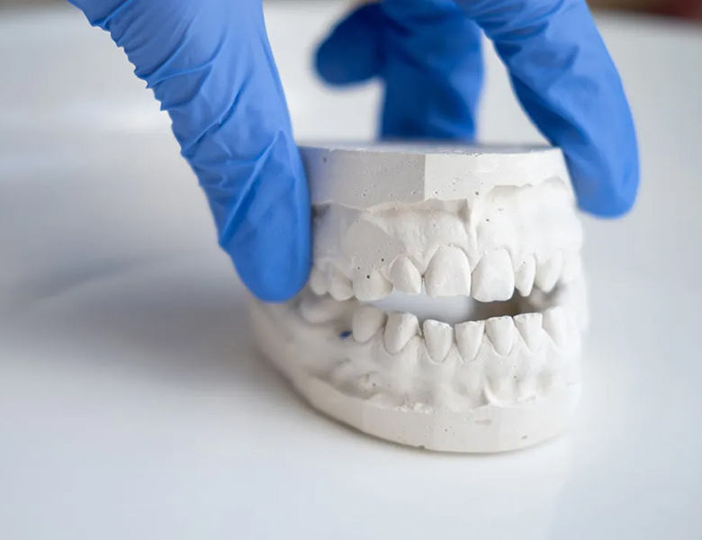 東京の歯医者、高輪歯科の睡眠歯科医療サービス、オーラルスリープ™の睡眠時ブラキシズム（歯ぎしり）