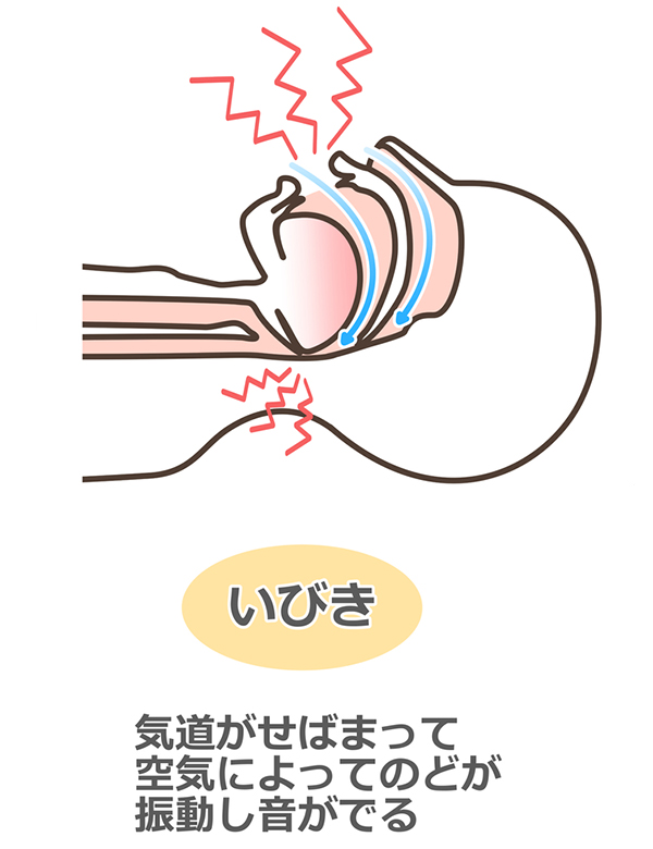 東京の歯医者、高輪歯科の睡眠歯科医療サービス、オーラルスリープ™で、いびきの種類と対策について解説