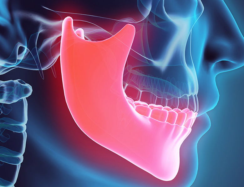 東京の歯医者、高輪歯科の睡眠歯科医療サービス、オーラルスリープ™のナイトガード